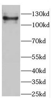 CC2D1B Rabbit Polyclonal Antibody
