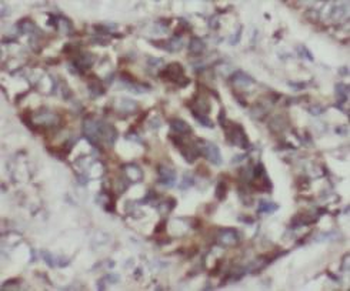 CC2D2A Rabbit Polyclonal Antibody