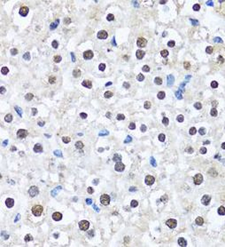 CCAR2 Rabbit Polyclonal Antibody