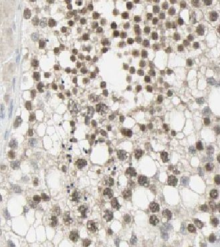 CFAP36 Rabbit Polyclonal Antibody