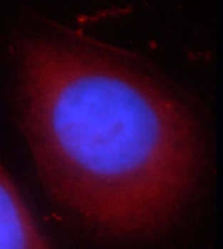 CCDC153 Rabbit Polyclonal Antibody