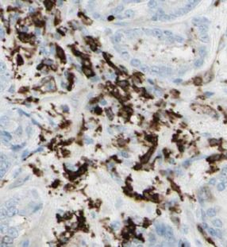 CCDC153 Rabbit Polyclonal Antibody