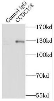 CCDC158 Rabbit Polyclonal Antibody