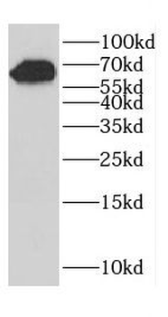 CCDC158 Rabbit Polyclonal Antibody