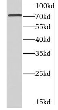 CCDC22 Antibody