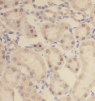 CCDC27 Rabbit Polyclonal Antibody
