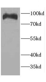 CCDC40 Antibody