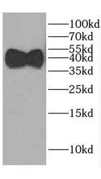 HAUS1 Rabbit Polyclonal Antibody