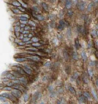 HAUS1 Rabbit Polyclonal Antibody