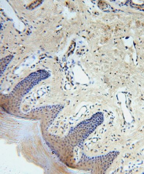 TMA7 Rabbit Polyclonal Antibody