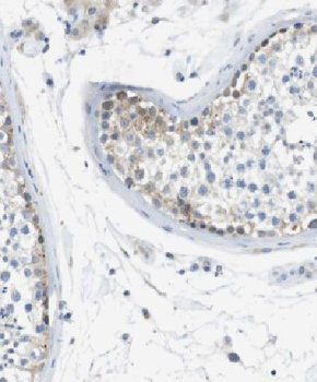 CCL27 Antibody