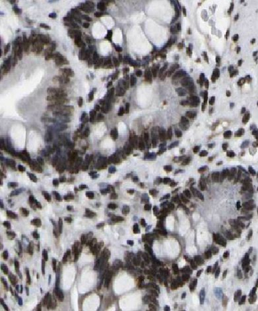 CCNI2 Rabbit Polyclonal Antibody