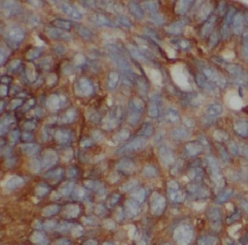 CCPG1 Rabbit Polyclonal Antibody