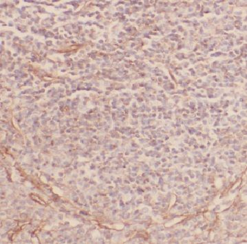 CCR10 Rabbit Polyclonal Antibody