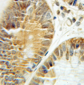 CCT3 Mouse Monoclonal Antibody