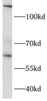 CCT6B Antibody