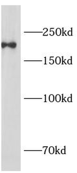 ITGAM Rabbit Polyclonal Antibody