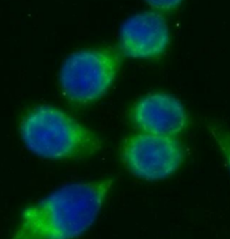 CD14 Antibody