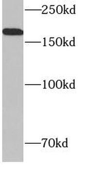 CD206 Rabbit Polyclonal Antibody