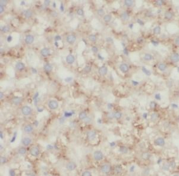 CD206 Rabbit Polyclonal Antibody