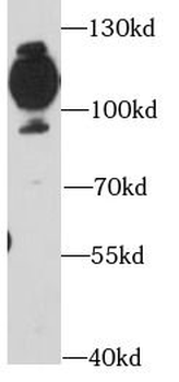 CD36 Rabbit Polyclonal Antibody
