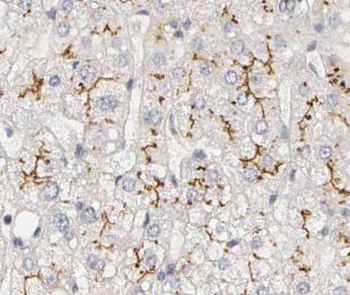 CD36 Rabbit Polyclonal Antibody