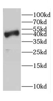 CD37 Rabbit Polyclonal Antibody