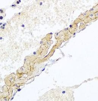 CD81 Rabbit Polyclonal Antibody