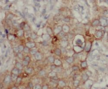 CD9 Rabbit Polyclonal Antibody