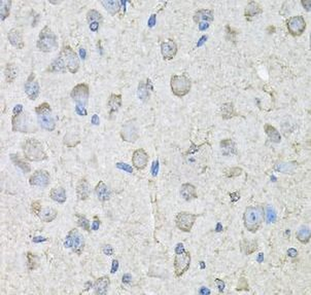 ADGRE5 Rabbit Polyclonal Antibody