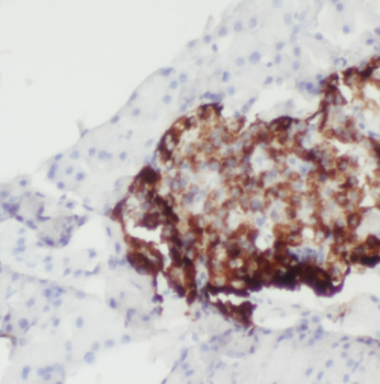 CD99 Rabbit Polyclonal Antibody
