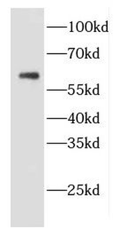 CDC25A Rabbit Polyclonal Antibody