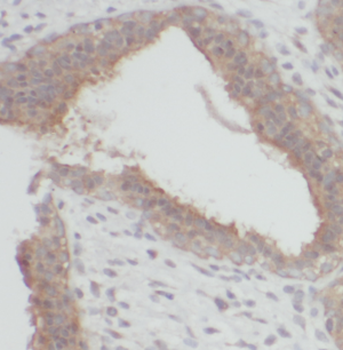 CDC25A Rabbit Polyclonal Antibody