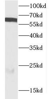 CDC6 Antibody