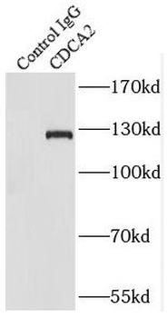 CDCA2 Antibody