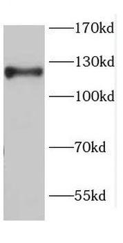 CDH17 Antibody