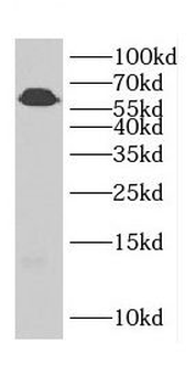 CDH23 Rabbit Polyclonal Antibody