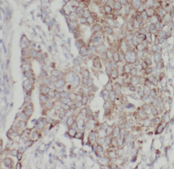 CDH26 Antibody