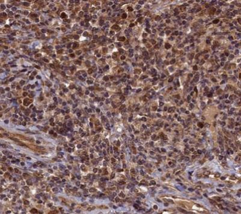 CDK1 Rabbit Polyclonal Antibody