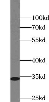 CDK4 Rabbit Polyclonal Antibody