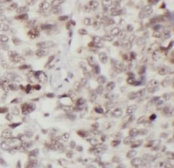CDK4 Rabbit Polyclonal Antibody