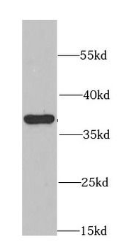 CDK6 Rabbit Polyclonal Antibody