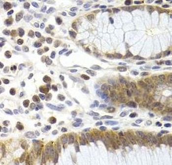 CDK6 Rabbit Polyclonal Antibody
