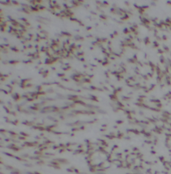CDK8 Rabbit Polyclonal Antibody