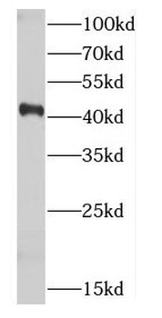 CDK9 Rabbit Polyclonal Antibody