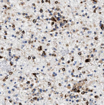 CDK9 Rabbit Polyclonal Antibody