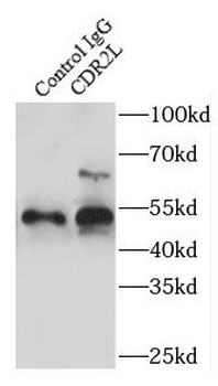 CDR2L Rabbit Polyclonal Antibody