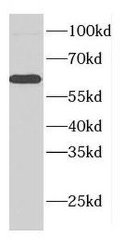 CDR2L Rabbit Polyclonal Antibody