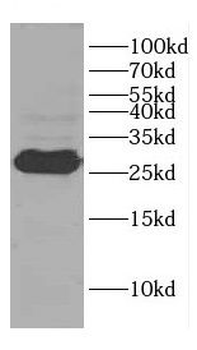 CENPH Antibody