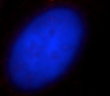 CENPJ Antibody